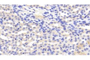 Detection of CAT in Mouse Kidney Tissue using Polyclonal Antibody to Catalase (CAT) (Catalase 抗体  (AA 80-239))