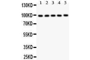 Anti- HCN1 antibody, Western blotting All lanes: Anti HCN1  at 0. (HCN1 抗体  (AA 618-890))