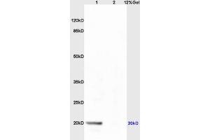 Lane 1: mouse live lysates Lane 2: mouse embryo lysates probed with Anti AVPR2 Polyclonal Antibody, Unconjugated (ABIN733478) at 1:200 in 4 °C. (Deoxyuridine Triphosphatase (DUT) (AA 151-252) 抗体)
