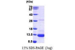 SDS-PAGE (SDS) image for Dynein, Light Chain, LC8-Type 1 (DYNLL1) (AA 1-89) protein (His tag) (ABIN667234) (DYNLL1 Protein (AA 1-89) (His tag))