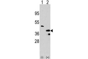 Western blot analysis of PRMT1 antibody and 293 cell lysate either nontransfected (Lane 1) or transiently transfected with the PRMT1 gene (2). (PRMT1 抗体  (AA 316-347))