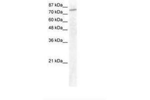 Image no. 1 for anti-General Transcription Factor IIIC, Polypeptide 3, 102kDa (GTF3C3) (AA 40-89) antibody (ABIN202944)