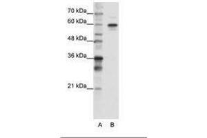 Image no. 3 for anti-Heterogeneous Nuclear Ribonucleoprotein L-Like (HNRPLL) (AA 24-73) antibody (ABIN202737) (HNRPLL 抗体  (AA 24-73))