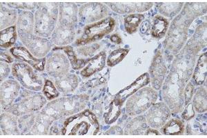 Immunohistochemistry of paraffin-embedded Mouse kidney using ITGAV Polyclonal Antibody at dilution of 1:50 (40x lens). (CD51 抗体)
