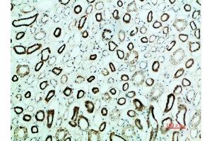 Immunohistochemical analysis of paraffin-embedded human-kidney, antibody was diluted at 1:200 (PTH1R 抗体  (AA 1268-1341))