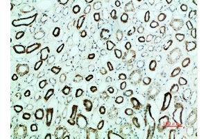 Immunohistochemical analysis of paraffin-embedded human-kidney, antibody was diluted at 1:200 (PTH1R 抗体  (AA 1268-1341))
