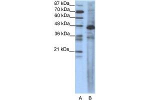 WB Suggested Anti-SRF Antibody Titration:  1. (SRF 抗体  (N-Term))