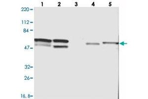 Western blot analysis of Lane 1: RT-4, Lane 2: U-251 MG, Lane 3: Human Plasma, Lane 4: Liver, Lane 5: Tonsil with CDCA7 polyclonal antibody  at 1:250-1:500 dilution. (CDCA7 抗体)