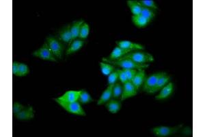 Immunofluorescence staining of HepG2 cells with ABIN7142464 at 1:100, counter-stained with DAPI. (HOGA1 抗体  (AA 1-164))