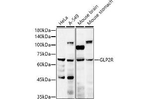 Western blot analysis of extracts of various cell lines, using GLP2R antibody (ABIN6127974, ABIN6141141, ABIN6141142 and ABIN6222287) at 1:500 dilution. (GLP2R 抗体  (AA 1-180))