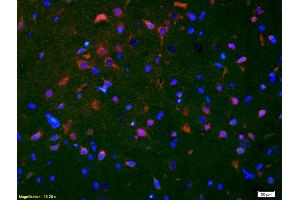 Formalin-fixed and paraffin-embedded rat brain labeled with Anti-Smoothened/SMO Polyclonal Antibody, Unconjugated (ABIN680908) 1:200, overnight at 4°C, The secondary antibody was Goat Anti-Rabbit IgG, Cy3 conjugated used at 1:200 dilution for 40 minutes at 37°C. (SMO 抗体  (AA 551-650))