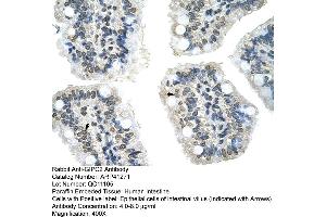 Rabbit Anti-GIPC2 Antibody  Paraffin Embedded Tissue: Human Intestine Cellular Data: Epithelial cells of intestinal villas Antibody Concentration: 4. (GIPC2 抗体  (N-Term))