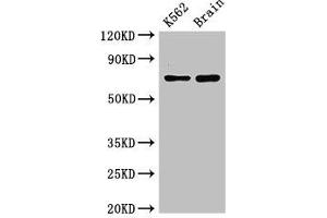 Western Blot Positive WB detected in: K562 whole cell lysate, Mouse brain tissue All lanes: SLU7 antibody at 3 μg/mL Secondary Goat polyclonal to rabbit IgG at 1/50000 dilution Predicted band size: 69 kDa Observed band size: 69 kDa (SLU7 抗体  (AA 138-310))