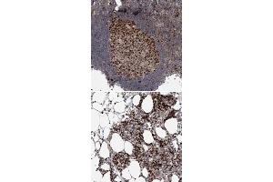 Immunohistochemical staining of human bone marrow with KIF4A polyclonal antibody  shows strong nuclear positivity in hematopoietic cells at 1:200-1:500 dilution. (KIF4A 抗体)