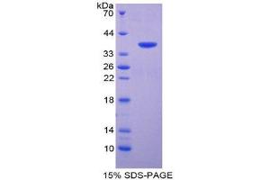 SDS-PAGE (SDS) image for Kininogen 1 (KNG1) (AA 367-430) protein (His tag,GST tag) (ABIN1981222) (KNG1 Protein (AA 367-430) (His tag,GST tag))