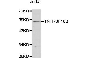 Western blot analysis of extracts of Jurkat cells, using TNFRSF10B antibody (ABIN1875126) at 1:1000 dilution. (TNFRSF10B 抗体)