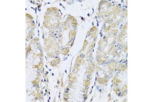 Immunohistochemistry of paraffin-embedded human stomach using FANCA antibody (ABIN5975159) at dilution of 1/100 (40x lens). (FANCA 抗体)