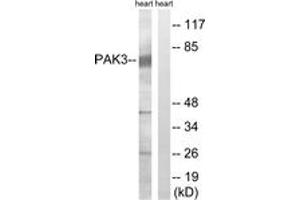 Western blot analysis of extracts from rat heart cells, using PAK3 (Ab-154) Antibody. (PAK3 抗体  (AA 121-170))