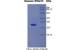 SDS-PAGE analysis of Human Interferon alpha 10 Protein.