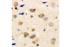 Immunohistochemical analysis of Caldesmon (pS789) staining in human brain formalin fixed paraffin embedded tissue section. (Caldesmon 抗体  (C-Term, pSer789))