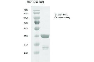 Recombinant BRDT (257-382), GST-tag protein gel. (BRDT Protein (AA 257-382) (GST tag))