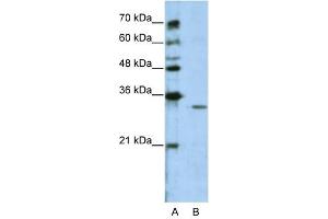 GNB1L antibody used at 2. (GNB1L 抗体)