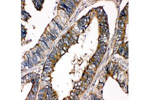IHC analysis of SHP2/PTPN11 using anti-SHP2/PTPN11 antibody (ABIN3043912).