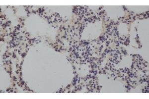 Immunohistochemistry of paraffin-embedded Rat lung using MMP8 Polyclonal Antibody at dilution of 1:50 (MMP8 抗体)