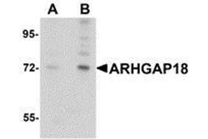 Western blot analysis of ARHGAP18 in 3T3 cell lysate with AP30079PU-N ARHGAP18 antibody at (A) 1 and (B) 2 μg/ml. (ARHGAP18 抗体  (C-Term))