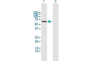 Western Blot analysis of RAG2 expression in transfected 293T cell line by RAG2 MaxPab polyclonal antibody. (RAG2 抗体  (AA 1-527))