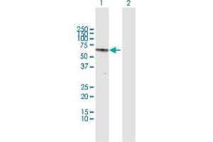 Western Blot analysis of RAG2 expression in transfected 293T cell line by RAG2 MaxPab polyclonal antibody.