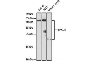 Western blot analysis of extracts of various cell lines using FBXO25 Polyclonal Antibody at dilution of 1:1000. (FBXO25 抗体)