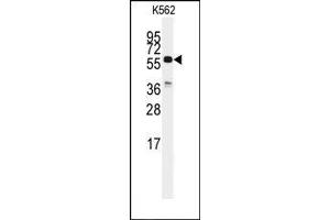 Image no. 1 for anti-Cell Division Cycle 25 Homolog C (S. Pombe) (CDC25C) (C-Term) antibody (ABIN360223) (CDC25C 抗体  (C-Term))