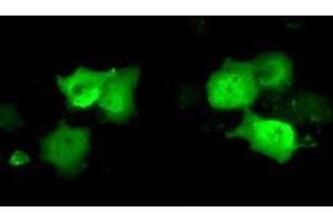 Anti-C21orf59 mouse monoclonal antibody (ABIN2452867) immunofluorescent staining of COS7 cells transiently transfected by pCMV6-ENTRY C21orf59 (RC200169). (C21orf59 抗体)