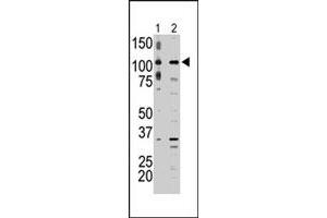 The MAP3K9 polyclonal antibody  is used in Western blot to detect MAP3K9 in A-375 cell lysate (lane 1) and rat testis tissue lysate (lane 2) . (MAP3K9 抗体  (C-Term))