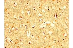 IHC image of ABIN7174409 diluted at 1:200 and staining in paraffin-embedded human brain tissue performed on a Leica BondTM system. (UBA52 抗体  (AA 1-128))