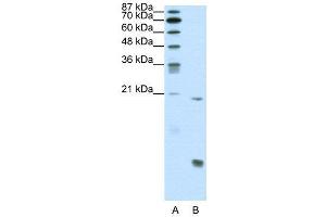 WB Suggested Anti-RUNX1  Antibody Titration: 0. (RUNX1 抗体  (N-Term))