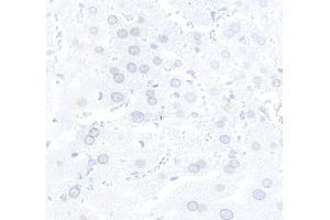 Immunohistochemistry (IHC) image for anti-Nucleoprotein TPR (TPR) (C-Term) antibody (ABIN7448922) (TPR 抗体  (C-Term))