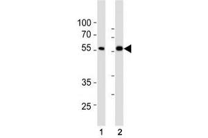 SMAD6 antibody western blot analysis in (1) HepG2 and (2) HT29 lysate. (SMAD6 抗体  (AA 358-386))