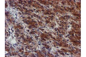 Image no. 1 for anti-Makorin Ring Finger Protein 1 (MKRN1) antibody (ABIN1499486) (MKRN1 抗体)