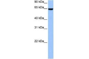 Collagen Type IV alpha 3 antibody used at 1 ug/ml to detect target protein. (COL4a3 抗体)