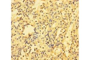 Immunohistochemistry of paraffin-embedded human spleen tissue using ABIN7171517 at dilution of 1:100 (ABI3BP 抗体  (AA 601-900))