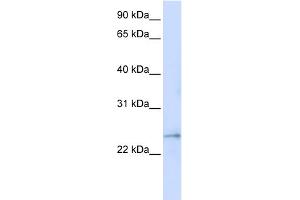 WB Suggested Anti-FAM156A Antibody Titration:  0. (FAM156A 抗体  (Middle Region))