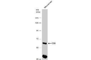 WB Image CBS antibody detects CBS protein by western blot analysis. (CBS 抗体)