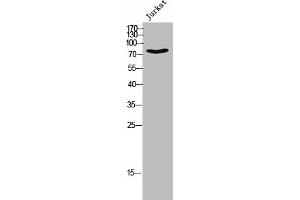 Western Blot analysis of JK cells using Phospho-DRP1 (S637) Polyclonal Antibody (Dynamin 1-Like 抗体  (pSer637))