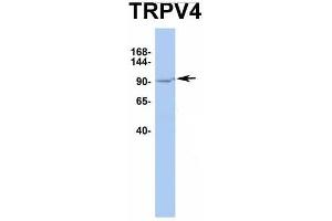 Western Blotting (WB) image for anti-Transient Receptor Potential Cation Channel, Subfamily V, Member 4 (TRPV4) (Middle Region) antibody (ABIN2776284)
