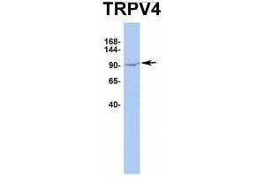 Host:  Rabbit  Target Name:  TRPV4  Sample Type:  HT1080  Antibody Dilution:  1. (TRPV4 抗体  (Middle Region))
