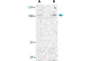 Western blot analysis of TRPC3 in mouse heart tissue lysate with TRPC3 polyclonal antibody  at (A) 1 and (B) 2 ug/mL . (TRPC3 抗体  (N-Term))