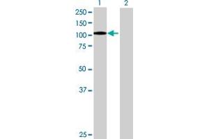 Western Blot analysis of ITGB2 expression in transfected 293T cell line by ITGB2 MaxPab polyclonal antibody. (Integrin beta 2 抗体  (AA 1-769))