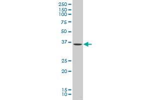 KLF2 polyclonal antibody (A01), Lot # HMS31060314QCS1. (KLF2 抗体  (AA 1-56))